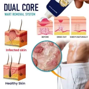 Genital Warts Remover Cream - Image 4