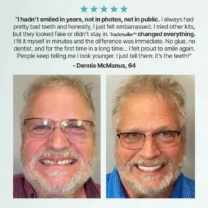 🌎Ends Today: 70% OFF! Full Denture with Strong Suctiond - Image 13