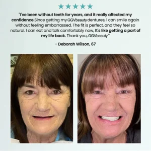 GGVbeauty Custom-Fit Dentures | At-Home Functional Teeth - Image 4