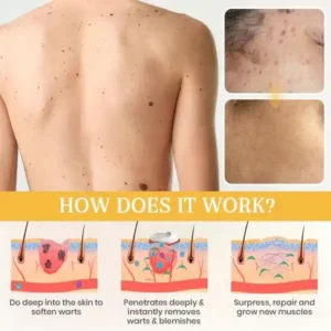 DermaErase Advanced Mole & Spot Removal Gel - Image 4