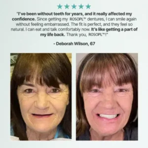 CustomFit Functional Dentures — Made in the USA, Up to 70% OFF for a More Confident Smile! - Image 6