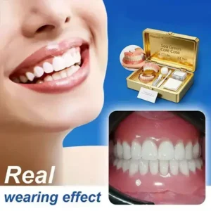 Full Denture with Strong Suction (2026 Comfort Fit) - Image 3