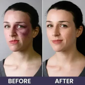 Bruise Repair & SkinStrengthening Cream - Image 15