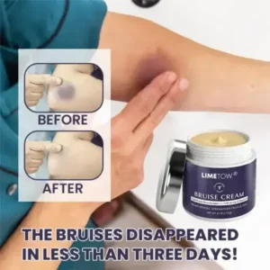 Bruise Repair & SkinStrengthening Cream - Image 5