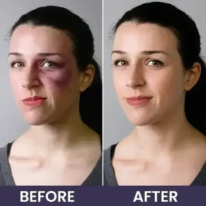 Bruise Repair & Skin-Strengthening Cream - Image 15