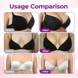 Breast Enhancement Nano Microneedle Patch - Image 6