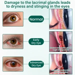 NEYEROS OptiClear Nano Eye Roller Serum - Image 8