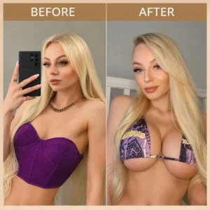 Breast Enhancement Nano Microneedle Patch | Targeted Bust & Glute Care - Image 2
