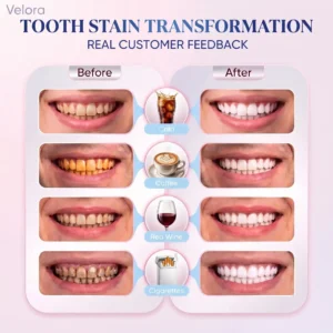 Niacinamide Toothpaste - Image 2