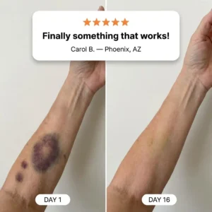 Bruise Repair & Skin-Strengthening Cream - Image 8