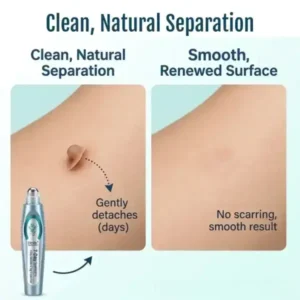 SpotlessPro Advanced Skin Care Pen - Image 7