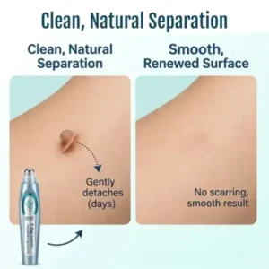 SpotlessPro Advanced Skin Care Pen - Image 7