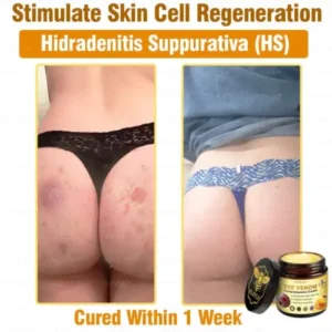 Bee Venom Comprehensive Cream - Image 9