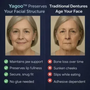 PREMIUM FULL DENTURE SET - Image 3