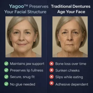 PREMIUM FULL DENTURE SET - Image 4