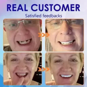 Vaxflite Full Denture Set (Top & Bottom) - Custom Fit Oral Prosthetic - Image 12