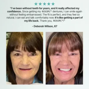 Custom-Fit Functional Dentures — Made in the USA, Up to 70% OFF for a More Confident Smile! - Image 4
