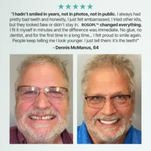 Custom-Fit Functional Dentures — Made in the USA, Up to 70% OFF for a More Confident Smile! - Image 5