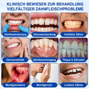 GumCare Pro | Zahnfleischpflege & Parodontal Gel - Image 4