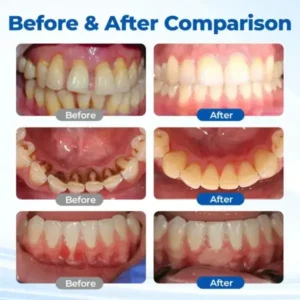 GumBiome Recovery Gel - Image 10