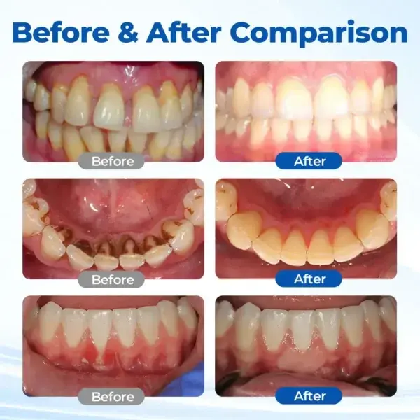 GumBiome Recovery Gel - Image 10
