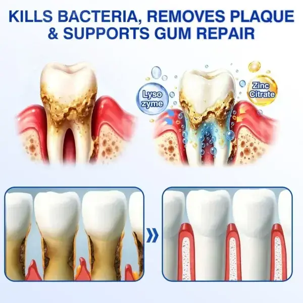 GumRevive Advanced Gum Care Gel - Image 9