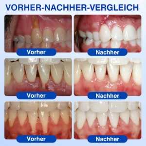 GumRevive Parodontitis Reparaturgel - Image 3