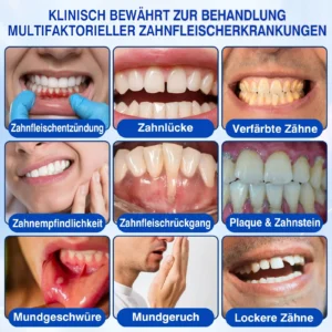 GumRevive Parodontitis Reparaturgel - Image 6