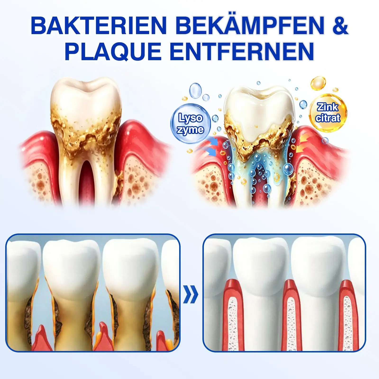 GumRevive Parodontitis Reparaturgel - Image 8