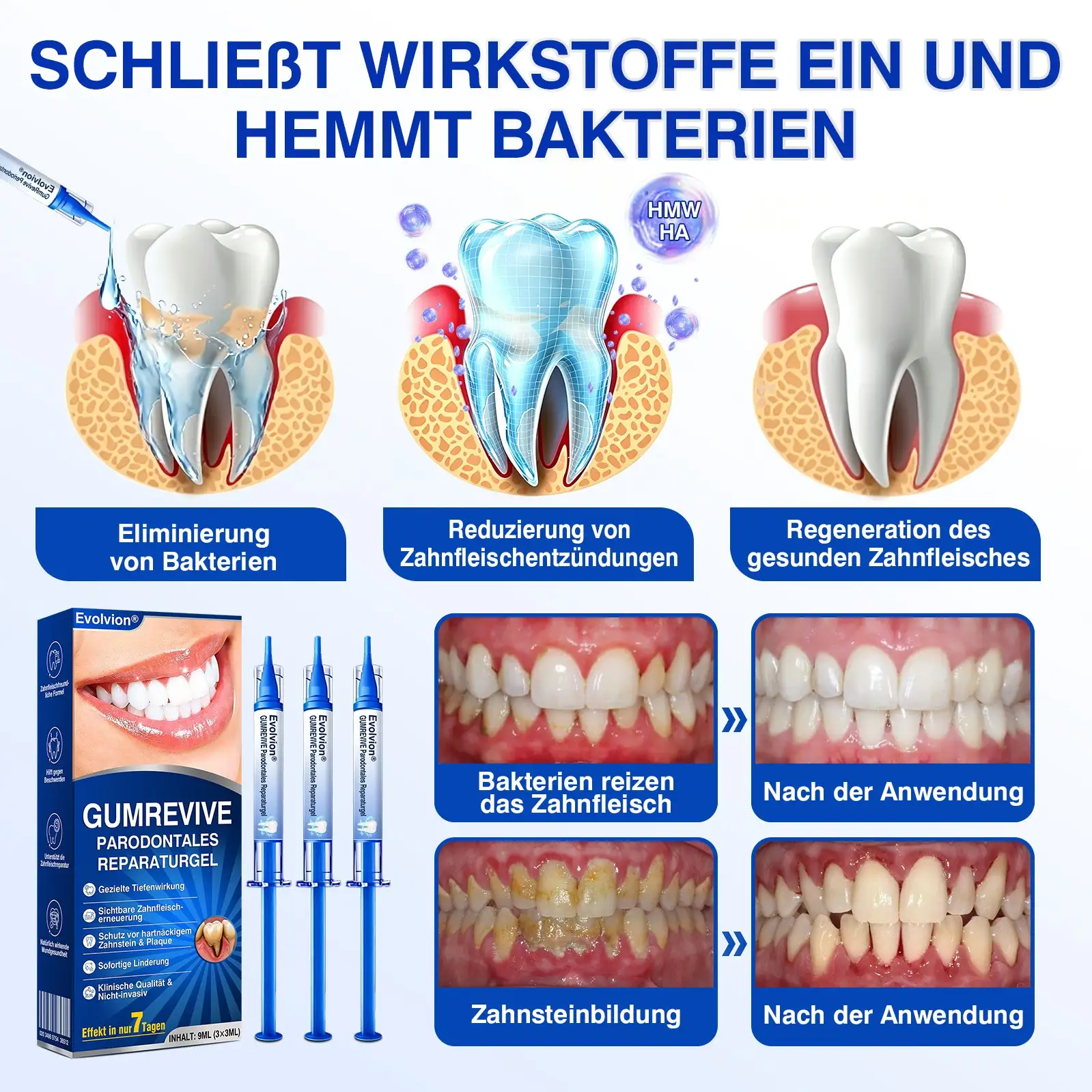GumRevive Parodontitis Reparaturgel - Image 9