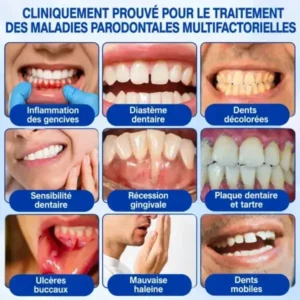 Gel Régénération Parodontale - Image 6