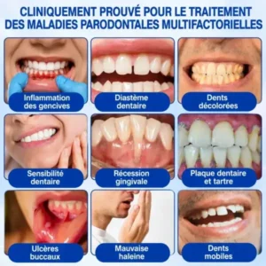 Gel Régénération Parodontale - Image 6