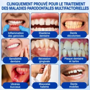 Gel Régénération Parodontale - Image 11