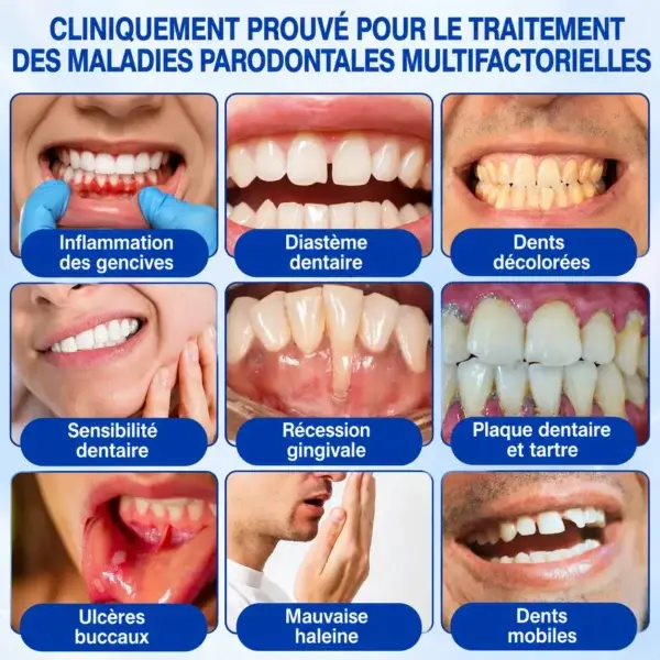 Gel Régénération Parodontale - Image 11
