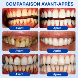 Gel Régénération Parodontale - Image 13