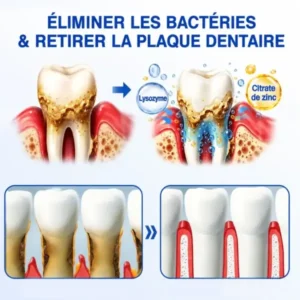Gel Régénération Parodontale - Image 7