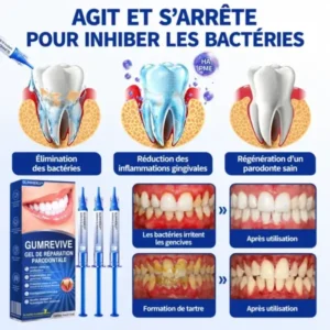 Gel Régénération Parodontale - Image 8