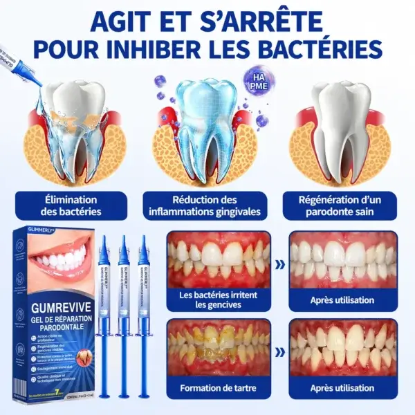 Gel Régénération Parodontale - Image 8