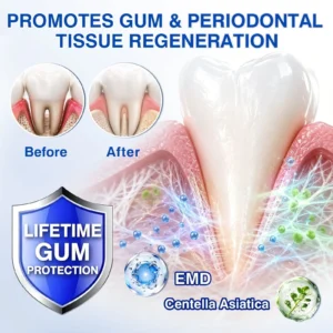 Gum Care Gel - Image 10