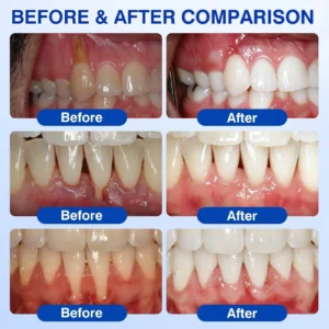 Gum Care Gel - Image 3