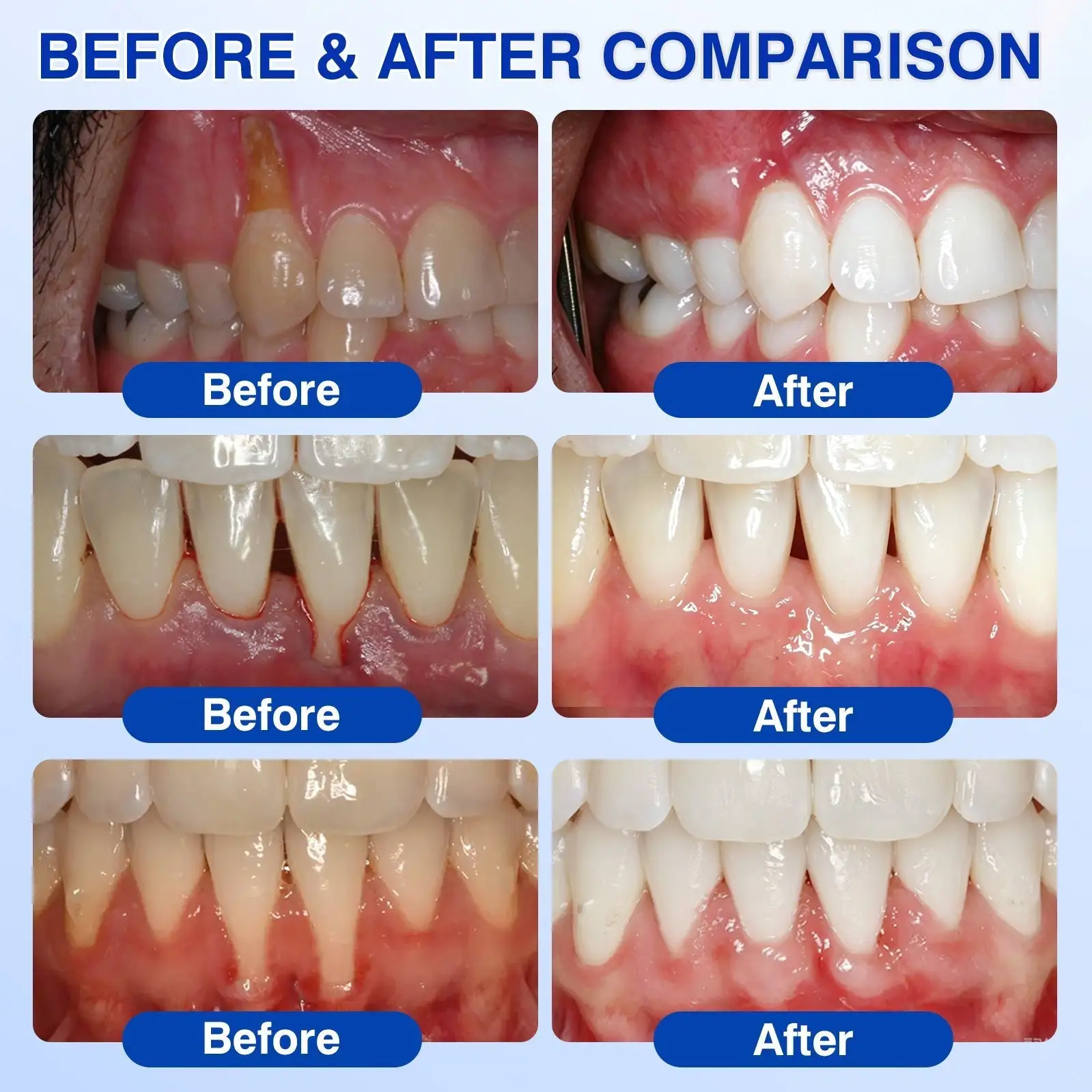 Gum Care Gel - Image 3