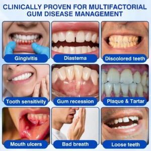 Gum Care Gel - Image 4