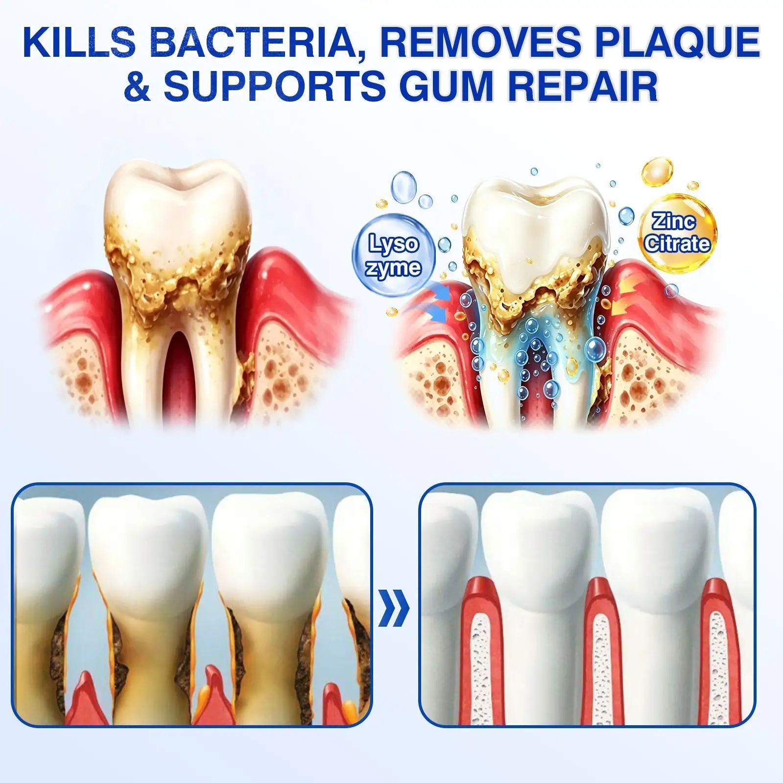 Gum Care Gel - Image 7