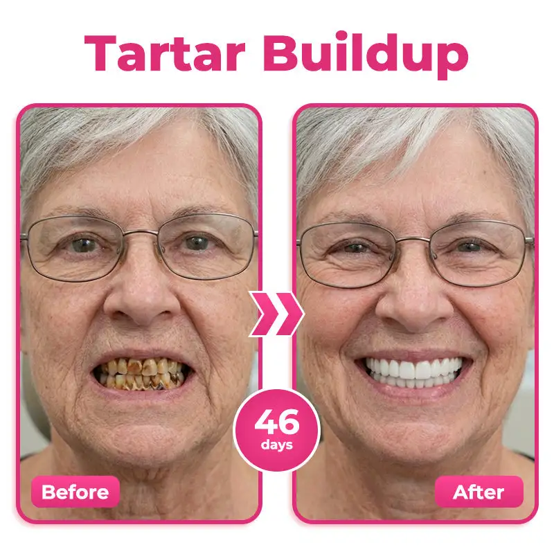 Enamel and Gum Therapy Toothpaste Serum - Image 2