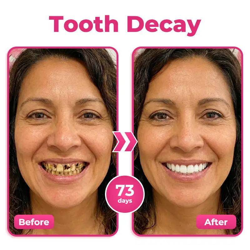 Enamel and Gum Therapy Toothpaste Serum - Image 3
