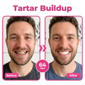 Enamel and Gum Therapy Toothpaste Serum - Image 4