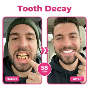 Enamel and Gum Therapy Toothpaste Serum - Image 5