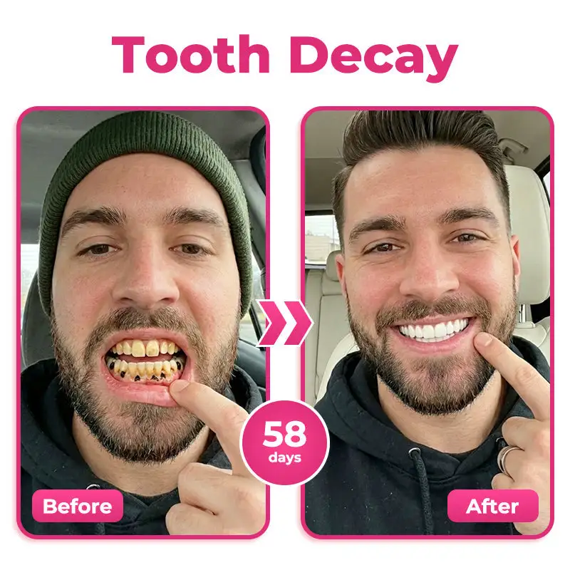 Enamel and Gum Therapy Toothpaste Serum - Image 5