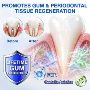 Natravor GumRevive Gum Regeneration Gel - Image 16