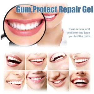 Nocztuce GumCare Support Gel - Image 11